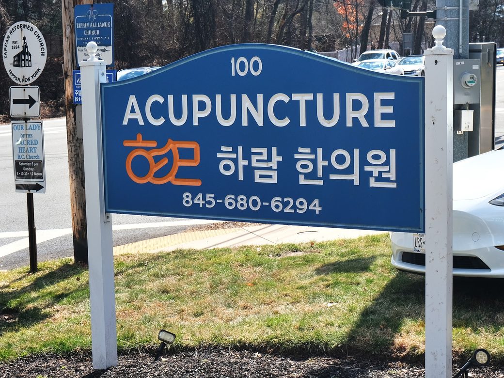 The blue roadside sign reading 100 Acupuncture with the clinic phone number